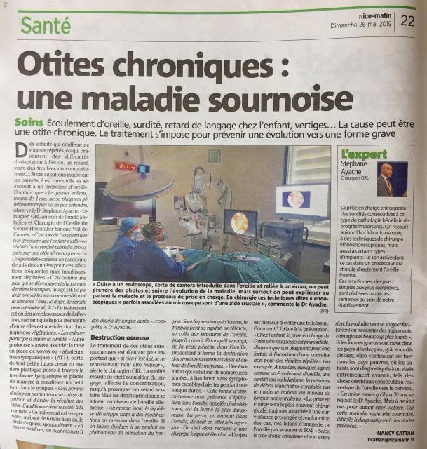 Article otites chroniques nice matin 26 5 19 copie